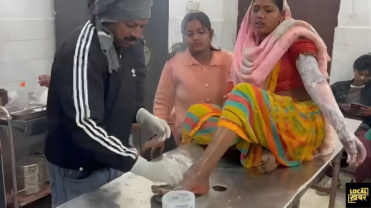 गिरिडीह में हैवानियत की हद: छेड़खानी का विरोध करने पर महिला पर डाला उबलता तेल, हालत गंभीर